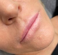 Lippen Vorher 2